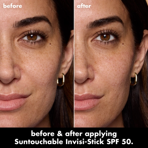 Before and After model image