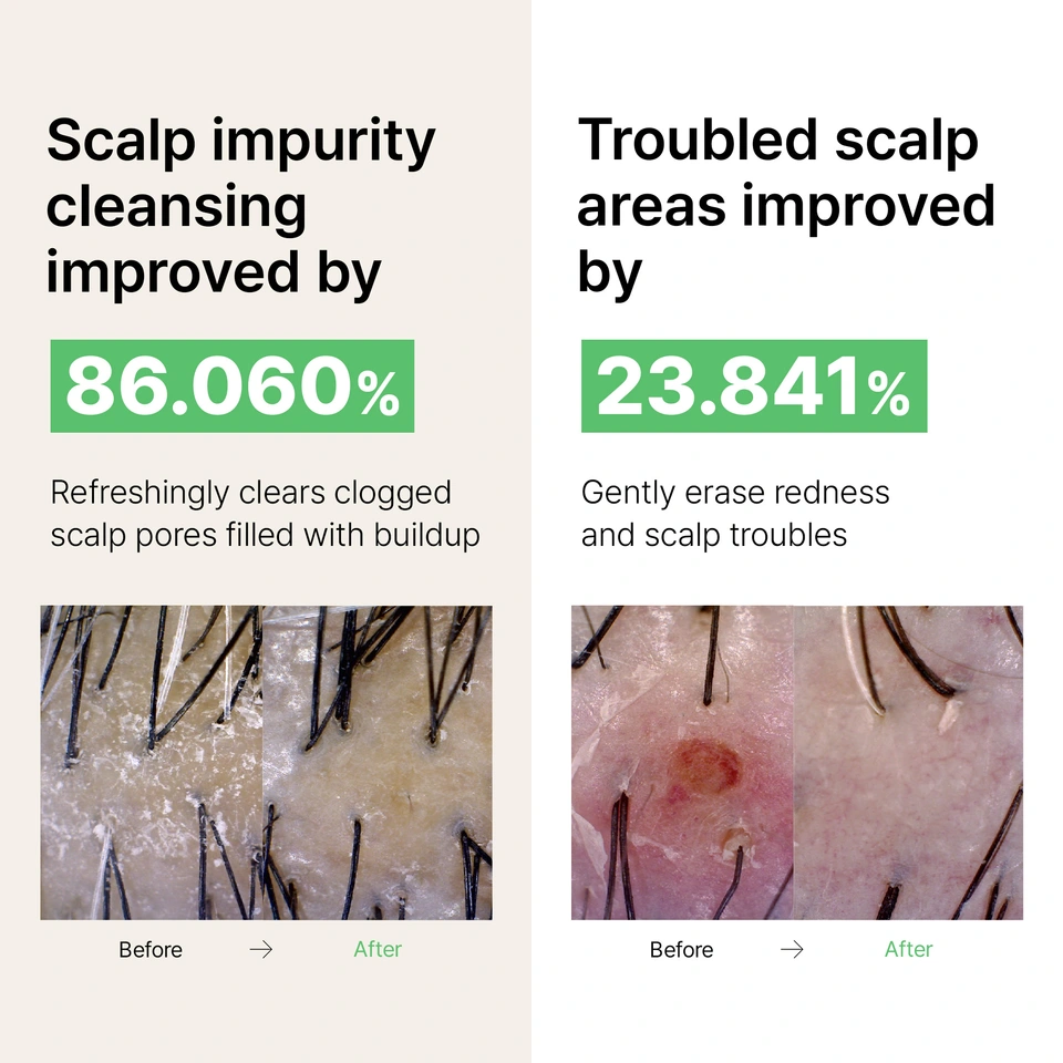 Tea Tree Calming Scalp Shampoo