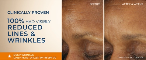 About RoC Retinol Correxion Deep Wrinkle Daily Moisturizer SPF 30