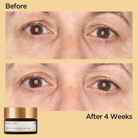 BEFORE &amp; AFTER: CORRECTIVE BRIGHTENING EYE CREAM