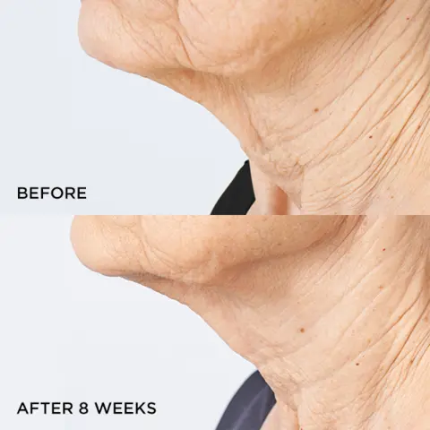 RESULTS YOU CAN SEE