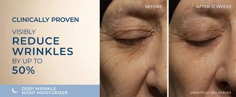About RoC Retinol Correxion Deep Wrinkle Night Moisturizer