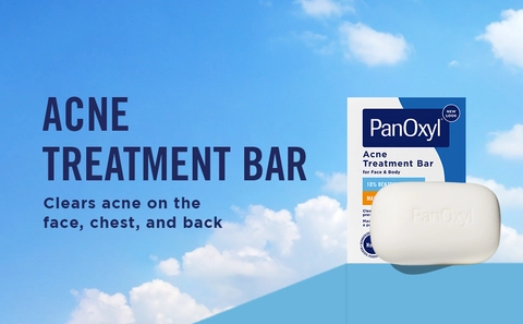Acne Treatment Bar: Clears acne on the face, chest, and back