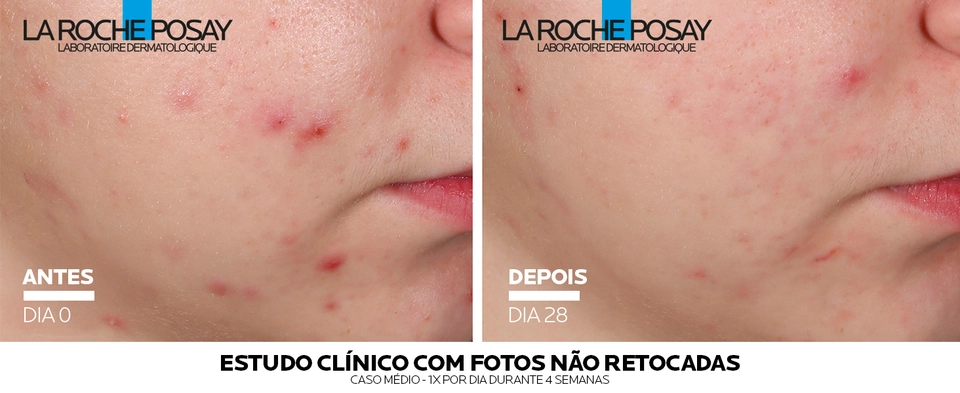 EFFACLAR SERUM ULTRA CONCENTRADO