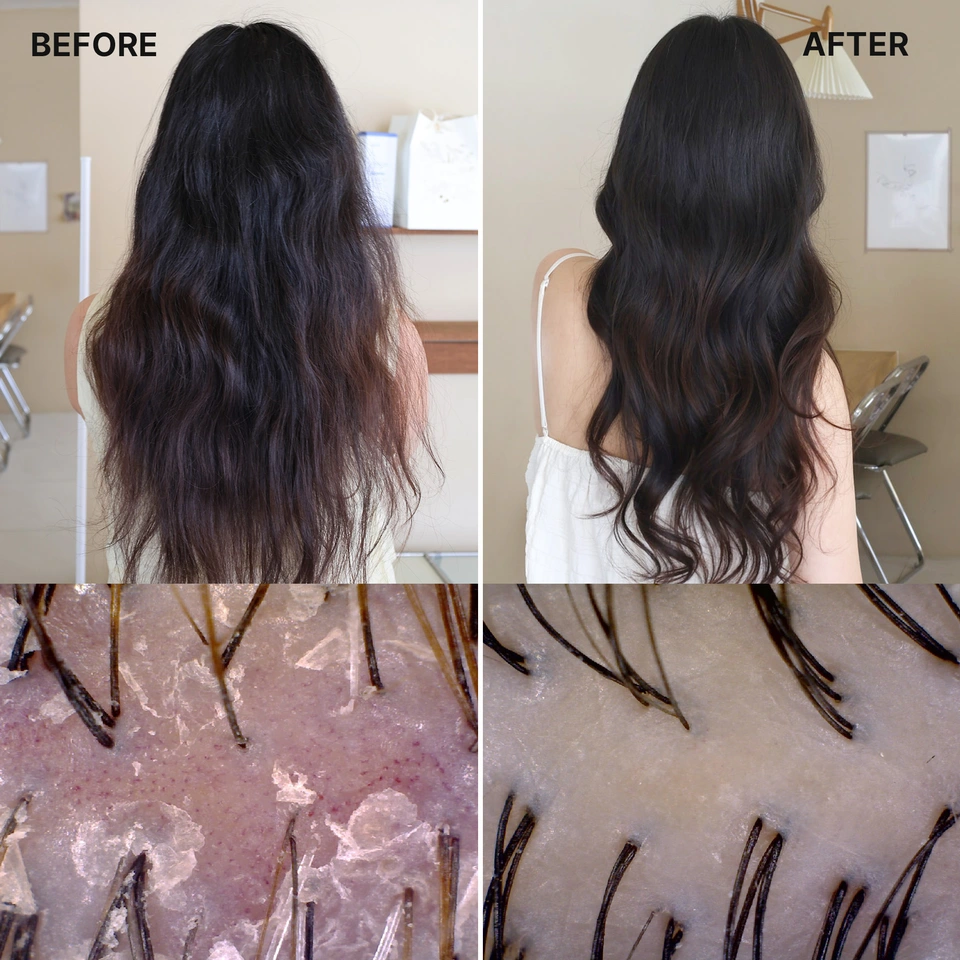 Tea Tree Calming Scalp Shampoo