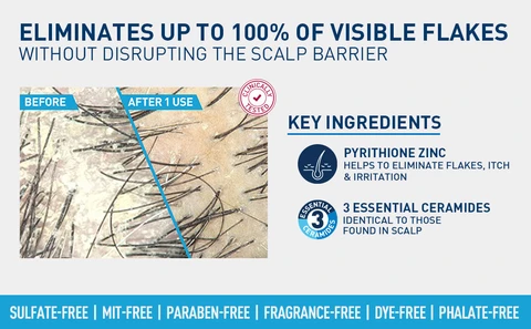 Dandruff range before and after
