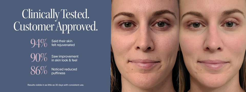 before and after images