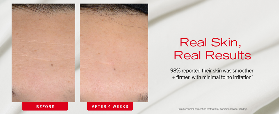Before + After use of Retinol serum showing reduced fine lines