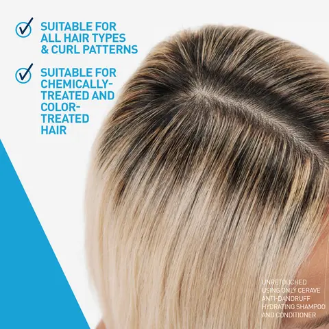 dandruff suitable for all