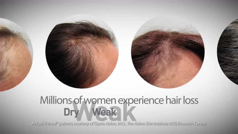 thumbnail video image 2 of Viviscal Man Hair Growth Supplement, 180 Tablets, 2 of 7