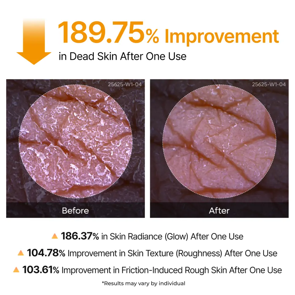 Peel Shot Exfoliating Kojic Acid Turmeric Spray