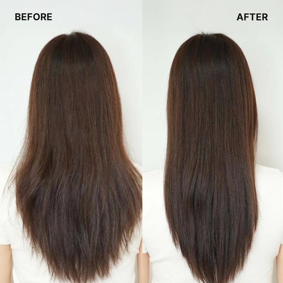 ACV Vinegar Treatment