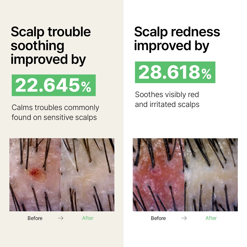 Tea Tree Calming Scalp Dry Shampoo