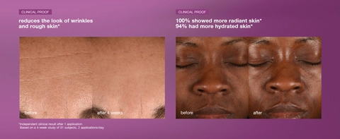 Before and after skin texture showing reduced wrinkles and smoother appearance
