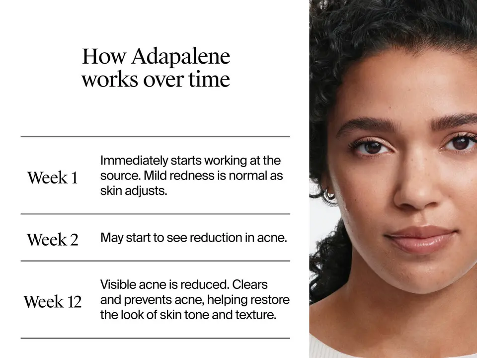 retinoids for face, retinoid serum, gentle retinoid, acne retinol acne gel anti acne acne prone skin