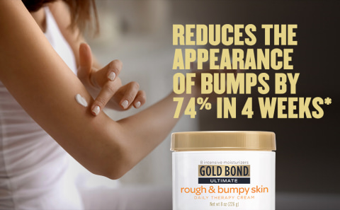 gold bond rough and bumpy