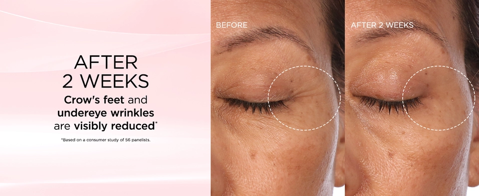 Retinol + HPR Eye