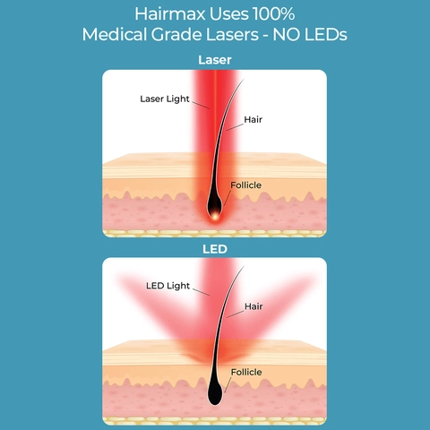 Lasers Vs LEDs