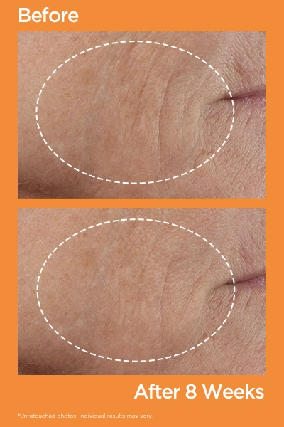 RESULTS YOU CAN SEE