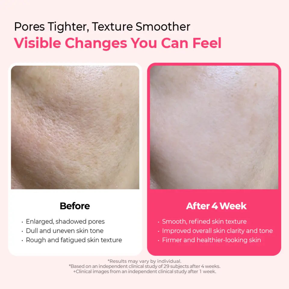Cyano Pink Spicule Serum