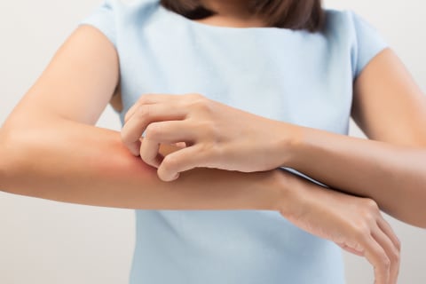 Close up of hand itching rash on arm