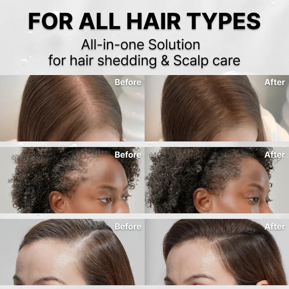 Grow:Turn Exosome Brush Ampoule