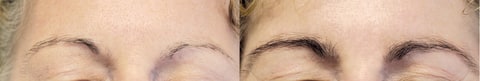 RapidBrow&#174; Eyebrow Enhancing Serum