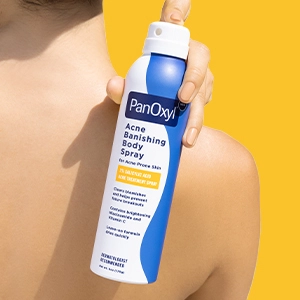A person facing away from the camera and holding PanOxyl Acne Banishing Body Spray over their shoulder.