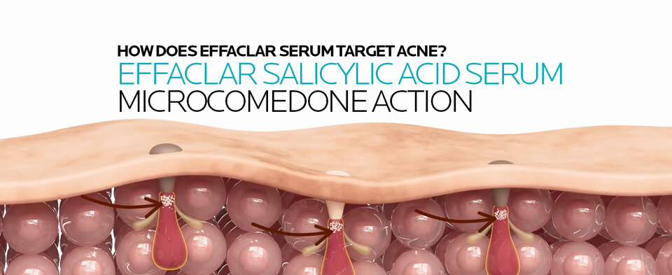 thumbnail video image 2 of La Roche-Posay Effaclar Salicylic Acid Acne Treatment Serum, 1.0 fl oz, 2 of 9