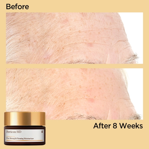 BEFORE &amp; AFTER NEUROPEPTIDE PRO-STRENGTH FIRMING MOISTURIZER