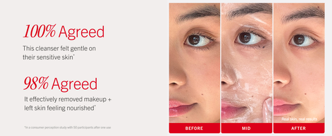 Skin before, during, and after cleansing with Pure Skin Face Cleanser showing clear skin